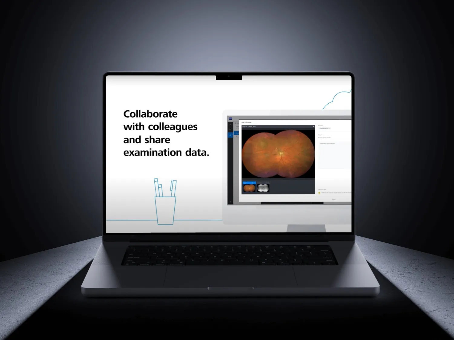 The ZEISS platform on a laptop, sharing an examination image with colleagues